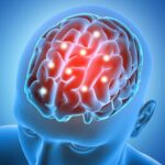 Neurologia