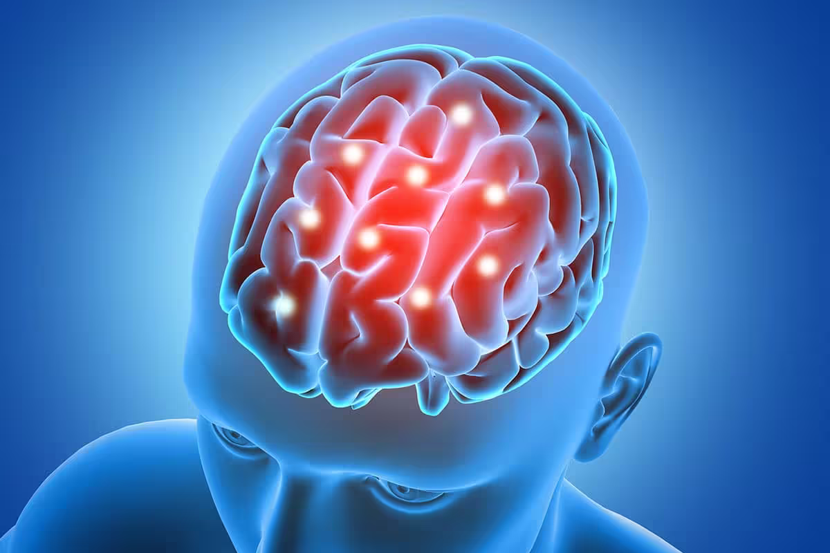 Neurologia